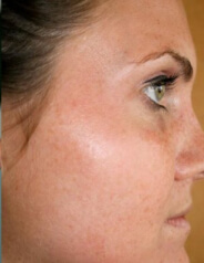 Moleculica creme erfahrungen